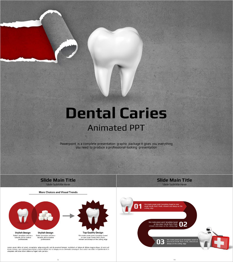 충치예방 애니메이션 피피티 템플릿 – 시각적 임팩트로 치아 건강을 전하는 디자인
