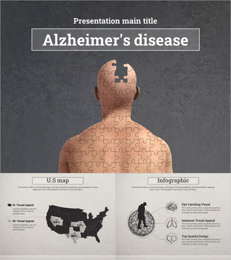 알츠하이머 애니메이션 프레젠테이션 – 시각 효과로 주목받는 디자인