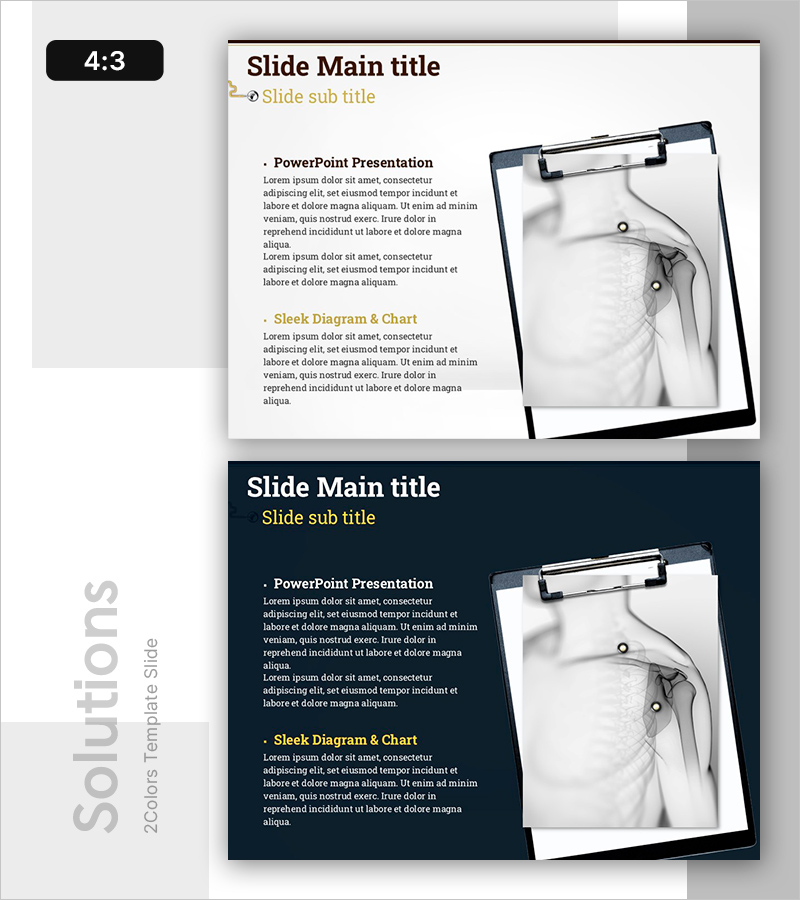 어깨 CT 분석 자료 – 리스크 관리와 해결 방안