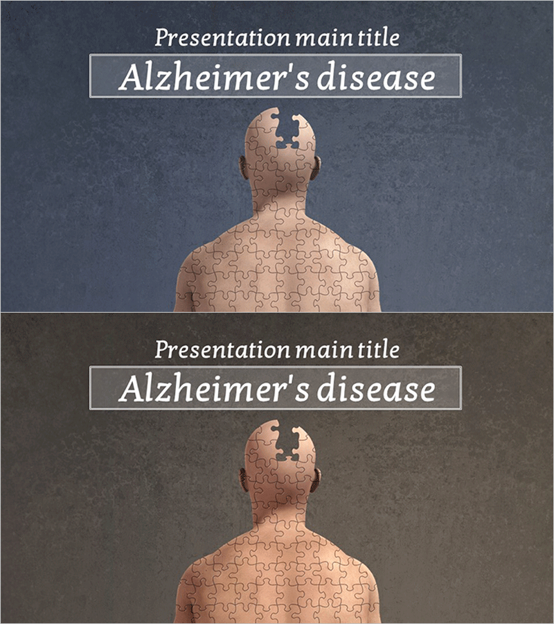 알츠하이머병 분석 템플릿 표지