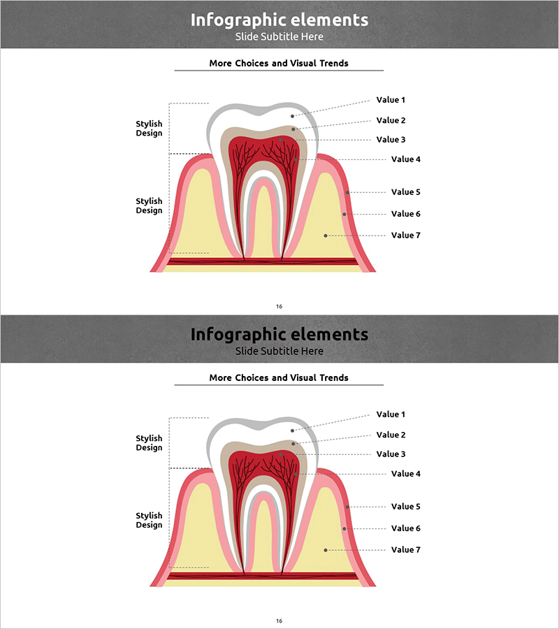 치아 구조 다이어그램 – 제품/서비스 세부 소개