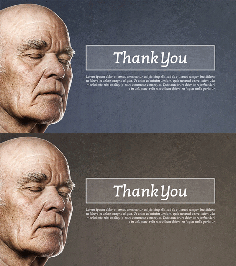 알츠하이머병 분석 템플릿 엔딩 표지