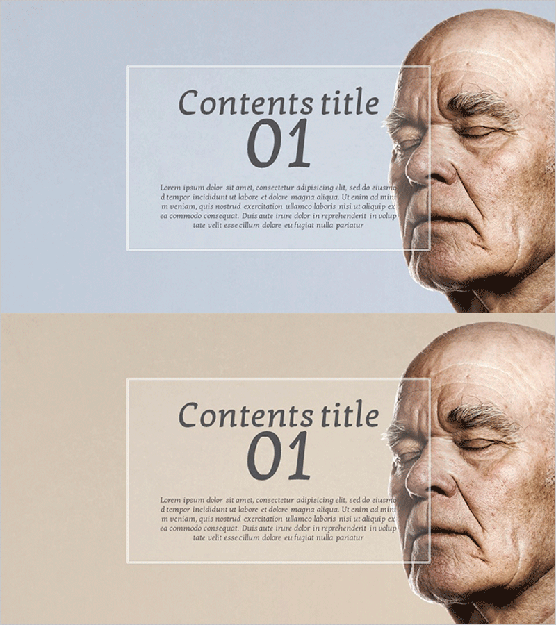 알츠하이머병 분석 템플릿 간지 - 인사이트 제공