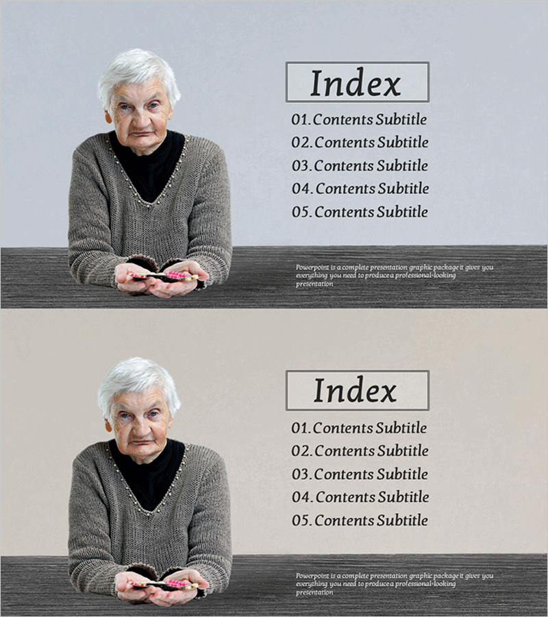 알츠하이머병 분석 템플릿 목차