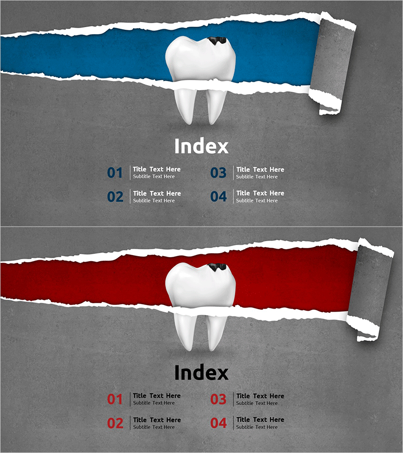 충치 원인 분석 목차 - 이해를 돕는 프레젠테이션