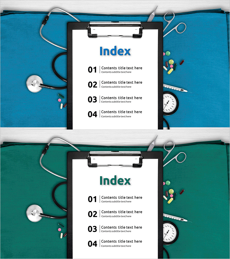 메디컬 수술 템플릿 목차 - 의료서적 및 프레젠테이션 완료