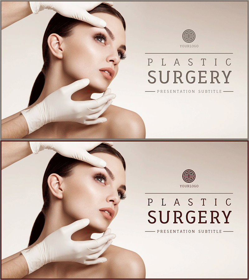 성형수술의 아름다움을 담은 표지 디자인 – 완벽함의 추구