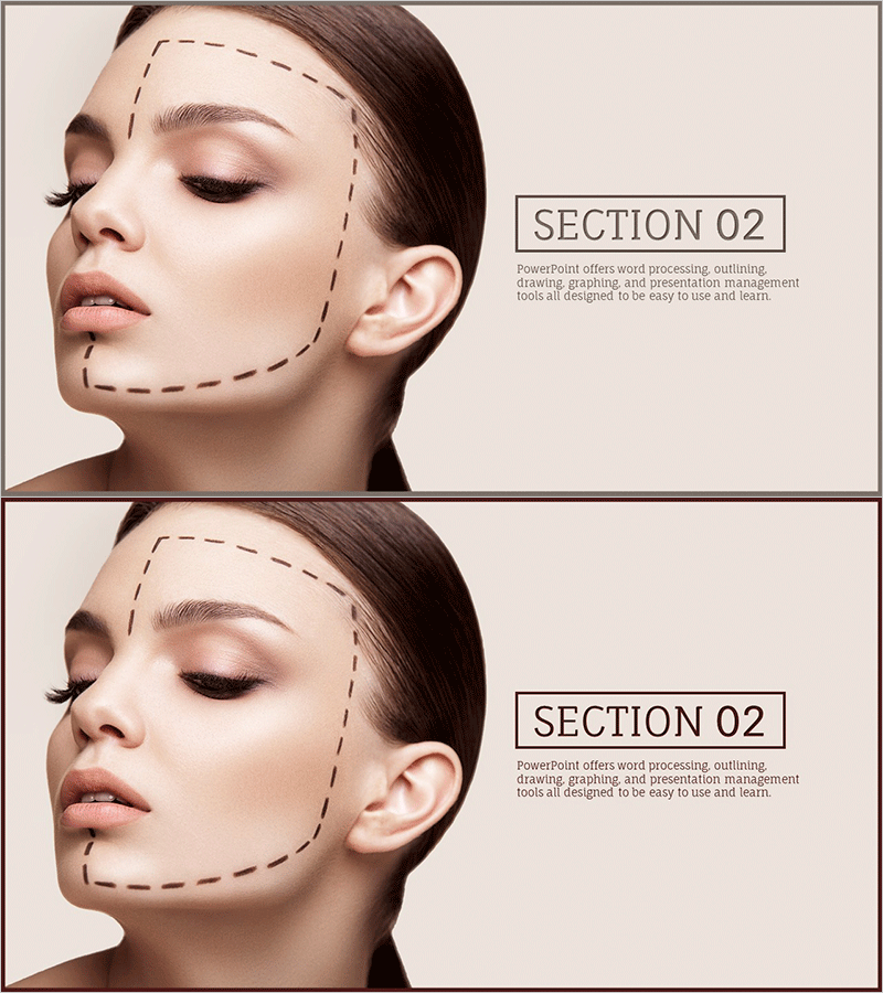성형 수술을 주제로 한 완벽한 아름다움 간지 슬라이드